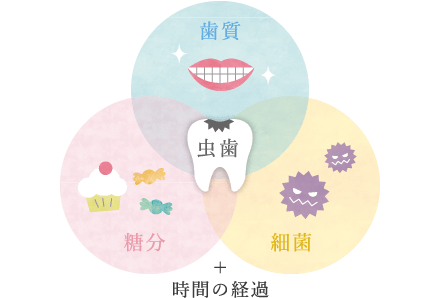 歯質・細菌・糖分＋時間の経過＝虫歯