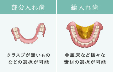 部分入れ歯…クラスプが無いものなどの選択が可能　総入れ歯…金属床など様々な素材の選択が可能