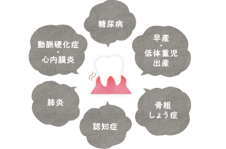 糖尿病、動脈硬化症・心内膜炎、肺炎、認知症、骨粗しょう症、早産・低体重児出産